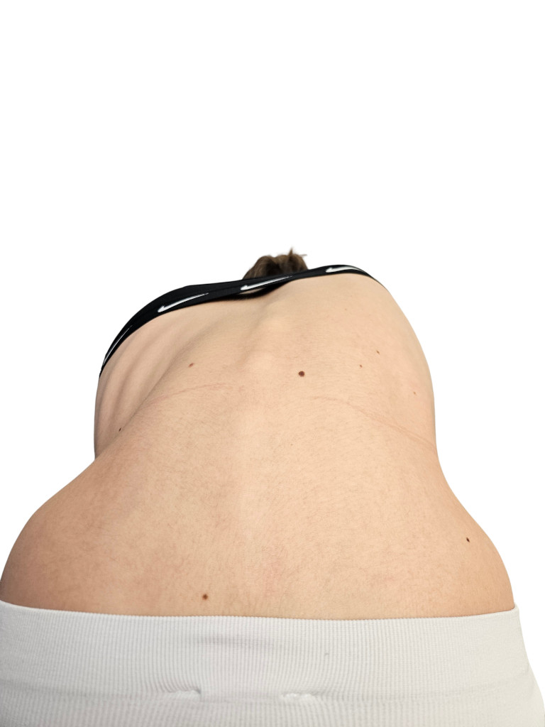 ortoza za hrbtenico